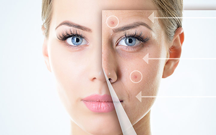 serum trị mụn