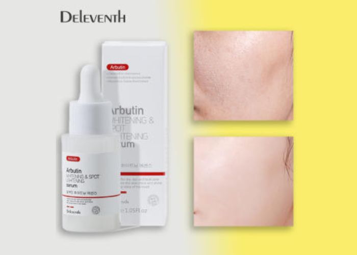 Review kết cấu serum Deleventh Arbutin có tốt không?
