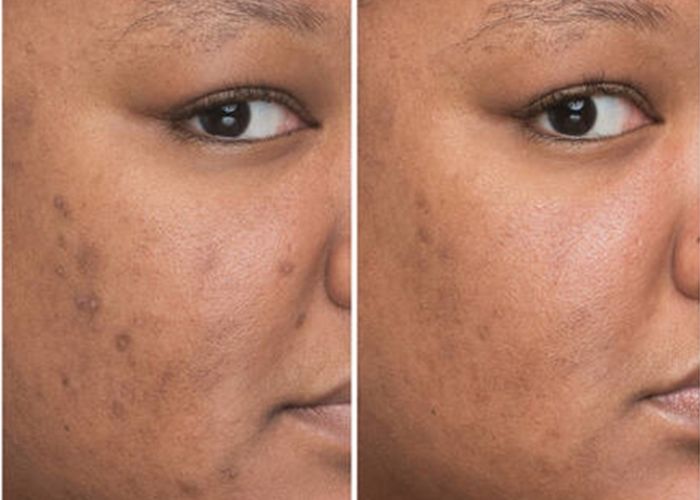 Cách dùng Serum Simplicity hiệu quả