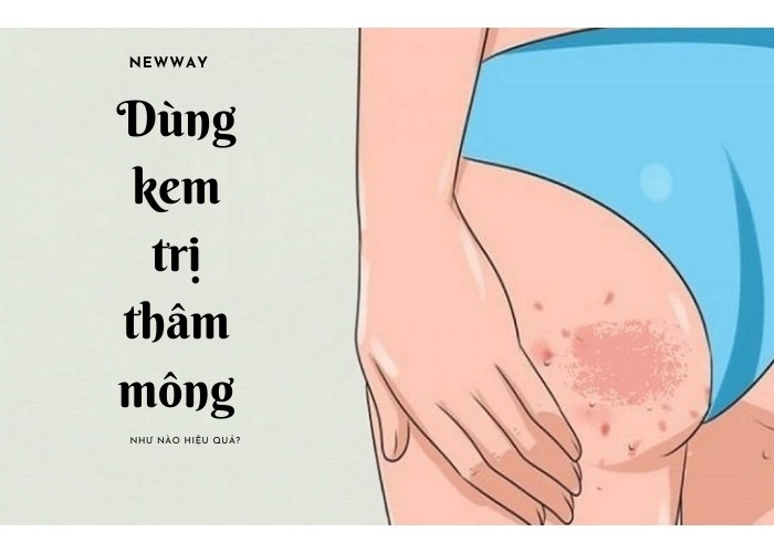Cách dùng kem trị thâm mông mang đến hiệu quả tuyệt vời