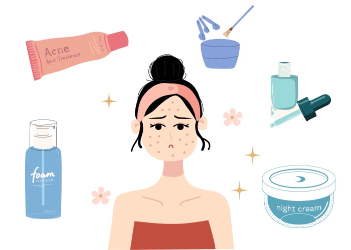 Những điều cần lưu ý khi sử dụng kem trị mụn