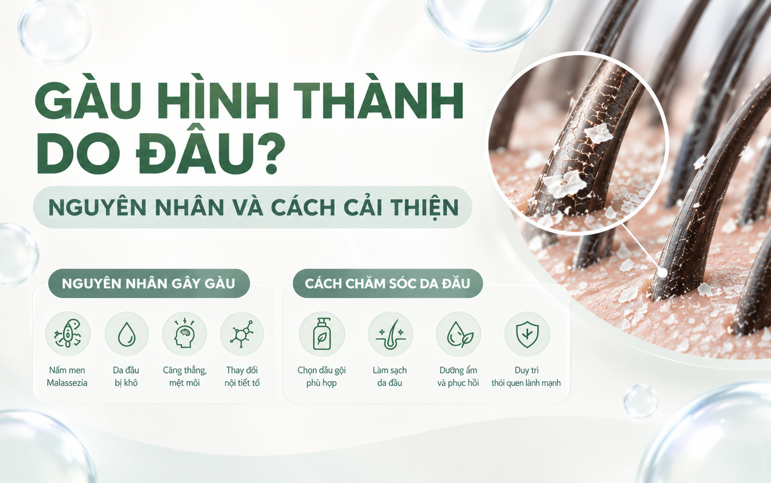 Nguyên Nhân Gây Gàu Và Cách Chăm Sóc Da Đầu Hiệu Quả