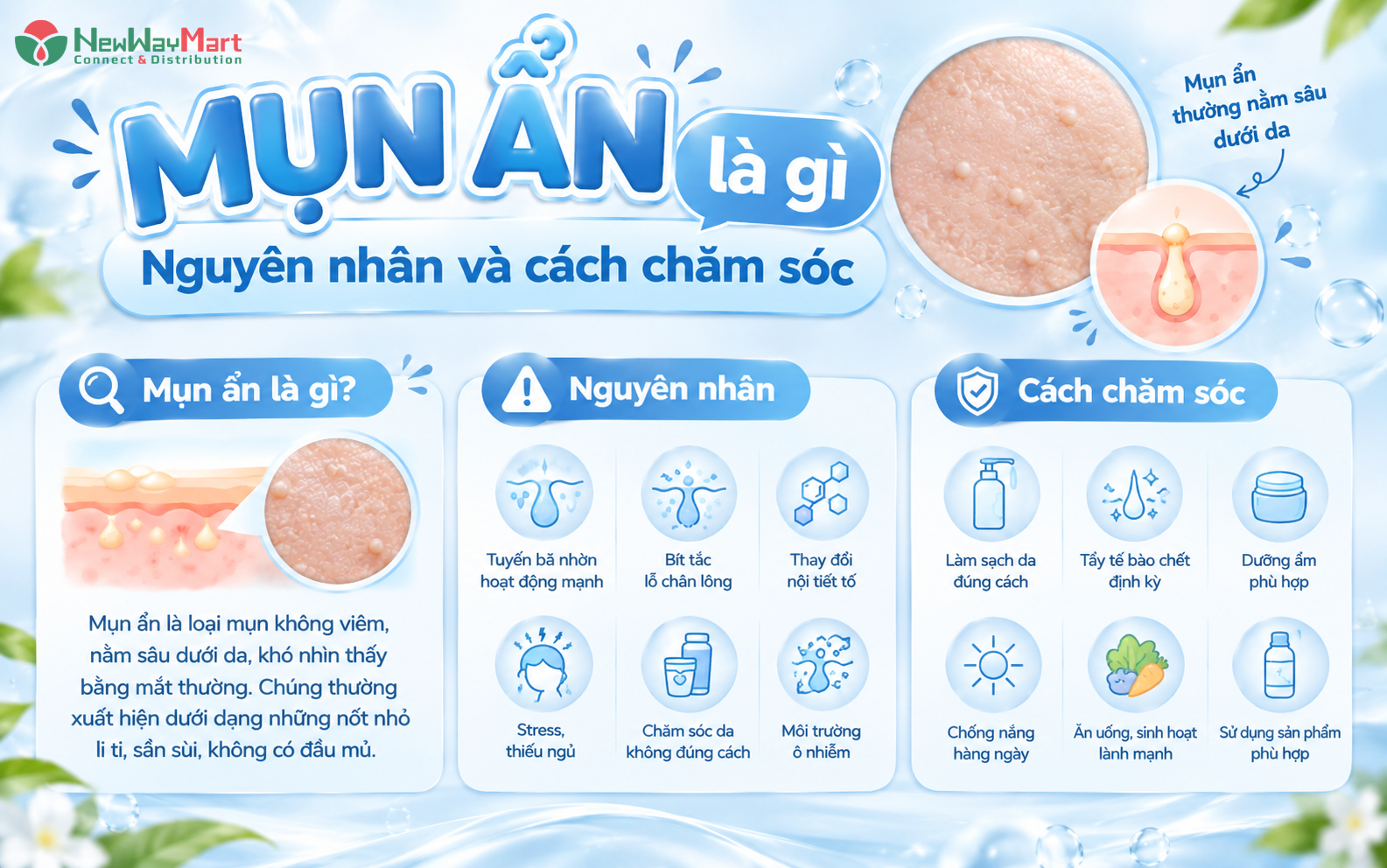 Mụn ẩn là gì? Nguyên nhân, dấu hiệu và cách chăm sóc da đúng cách