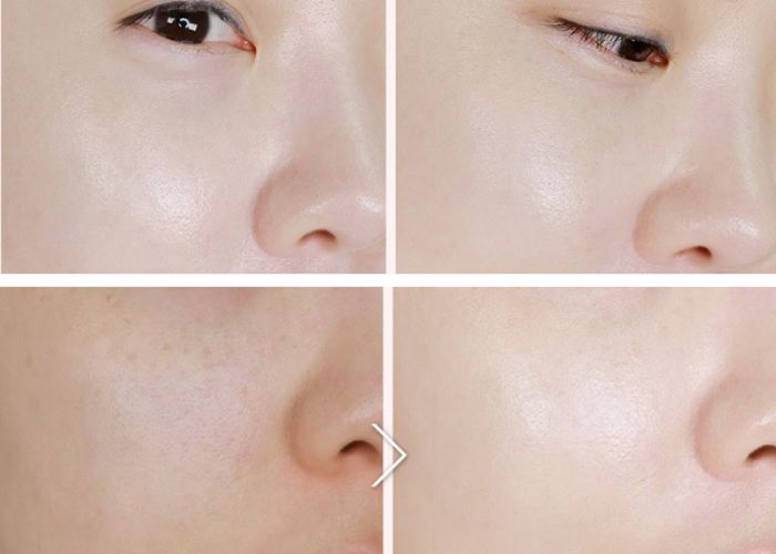 10+ Kem dưỡng trắng da bật tone của Nhật? Những chú ý khi lựa chọn và sử dụng kem dưỡng trắng da