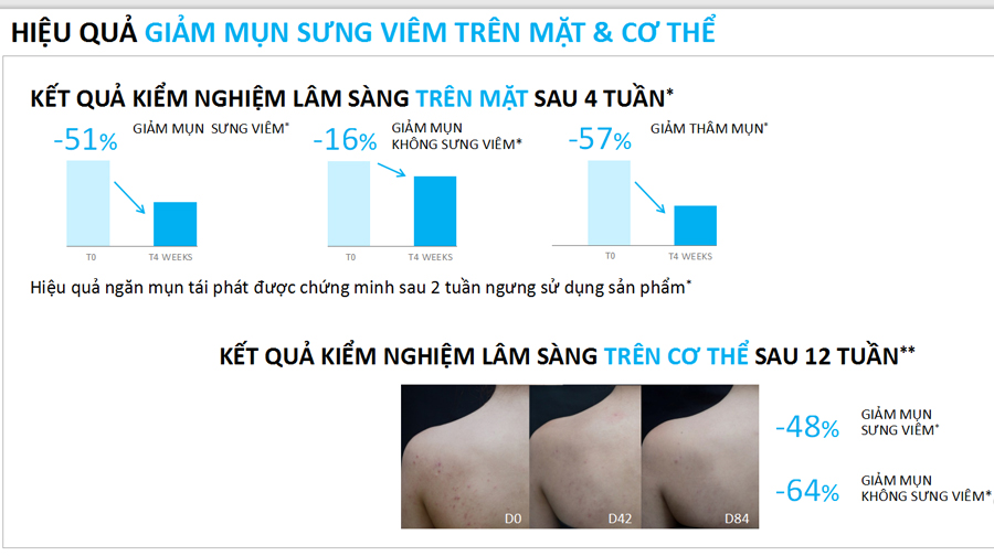 Gel Rửa Mặt & Tắm La Roche-Posay Làm Sạch & Giảm Mụn 400ml