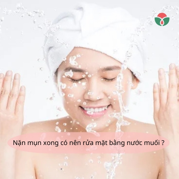 Nặn mụn xong có nên rửa mặt bằng nước muối không?