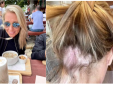 Sản phẩm chăm sóc tóc của Olaplex bị nghi có chứa thành phần gây hói